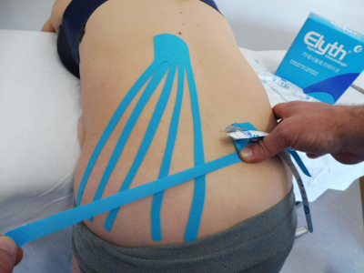 Kinesio-Tape als Teil der physiotherapeutischen Behandlung